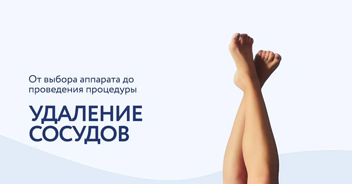 Лазеры для лечения сосудов и купероза: полный гид