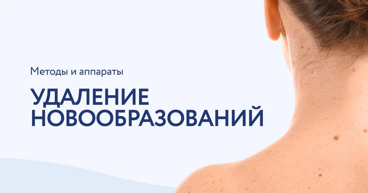 Современные методы и аппараты для удаления доброкачественных новообразований кожи: подробное руководство для косметологов