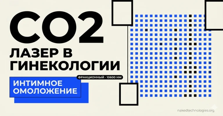 СО2-лазер в гинекологии: как выбрать аппарат для интимного омоложения — обзор моделей 2026